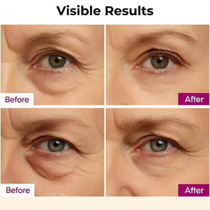 Baruva Calcium Multi Balm